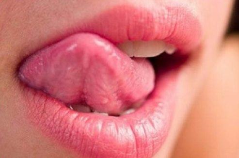 không đẩy lưỡi sau cấy implant 