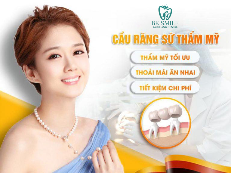 cầu răng sứ thẩm mỹ 