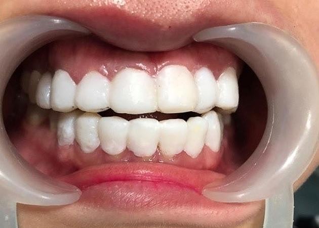 Những nguy cơ tiềm ẩn từ “công nghệ” đội lốt