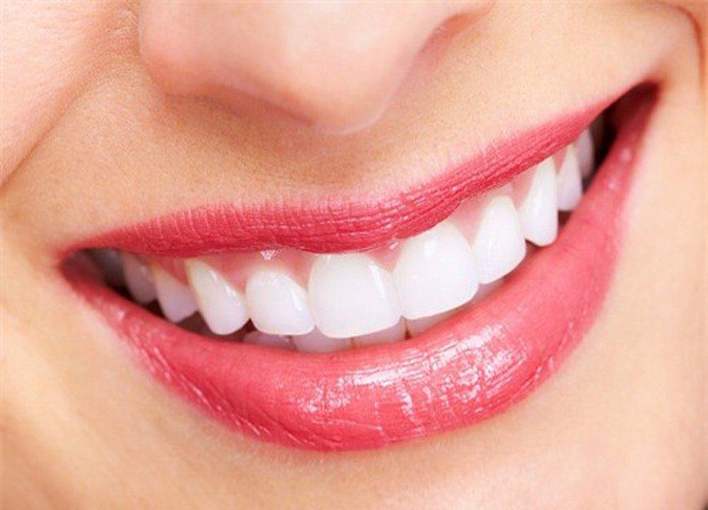 ưu - nhược điểm của răng sứ emax