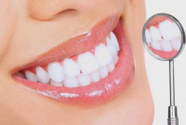 ưu - nhược điểm răng sứ nacera