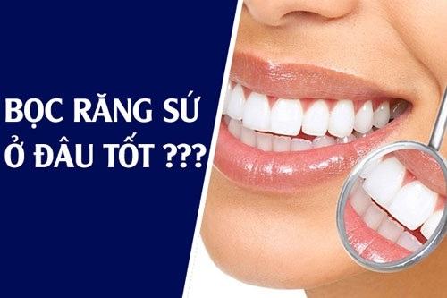 bọc răng sứ ở đâu tốt