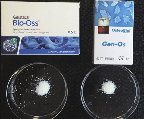 2 loại Geistlich Bio phổ biến nhất hiện nay