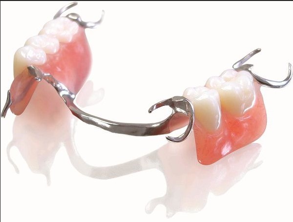 hàm tháo lắp trên khing kim loại