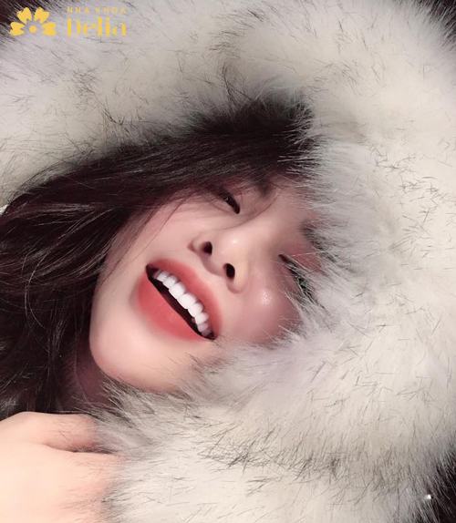 Phương Thúy tự tin với nụ cười rạng rỡ sau bọc răng thỏ tại Nha khoa Bảo Khang