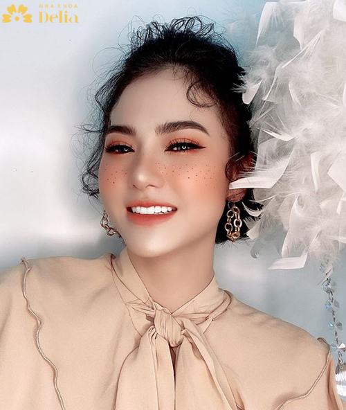 Dương Tây cũng là mẫu ảnh, hàm răng mới cũng tạo điểm nhấn giúp cô tỏa sáng 