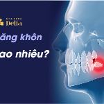 nhổ răng khôn bao nhiêu tiền