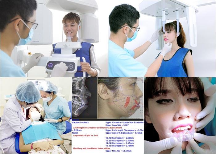 Khách hàng được thăm khám, kiểm tra và niềng răng tại Nha khoa Bảo Khang
