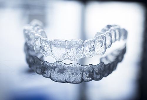 ưu - nhược điểm của niềng răng invisalign