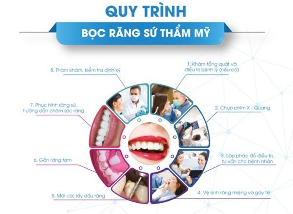 Quy trình bọc sứ cho răng thưa