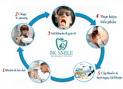 Quy trình nhổ răng khôn tại nha khoa thẩm mỹ Bảo Khang
