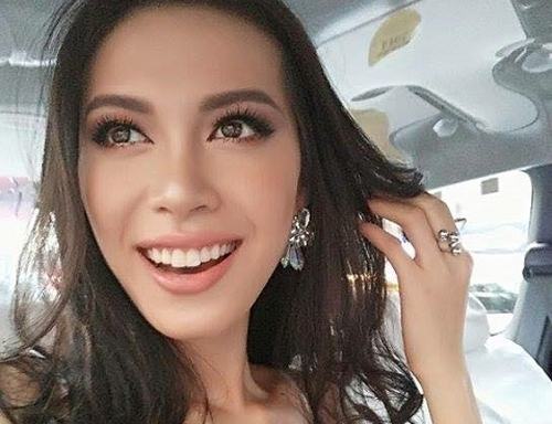 Siêu mẫu Minh Tú sở hữu dáng răng thỏ 