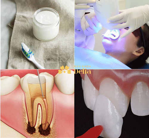 Các phương pháp chữa răng bị xỉn màu