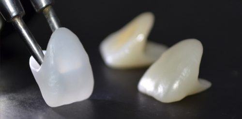 Răng sứ Cercon Zirconia