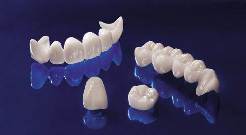 Răng sứ Cercon HT