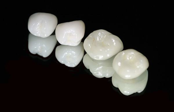 Răng sứ Cercon Zirconia cứng chắc và thẩm mỹ