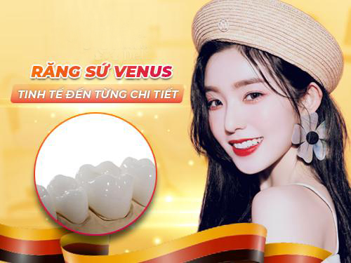 răng sứ venus là gì