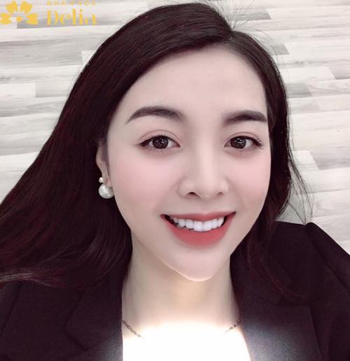 Khách hàng Phương Thúy thực hiện bọc sứ Ceramill với dáng răng thỏ cute