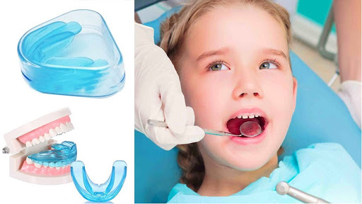 niềng răng silicon trainer có tốt không