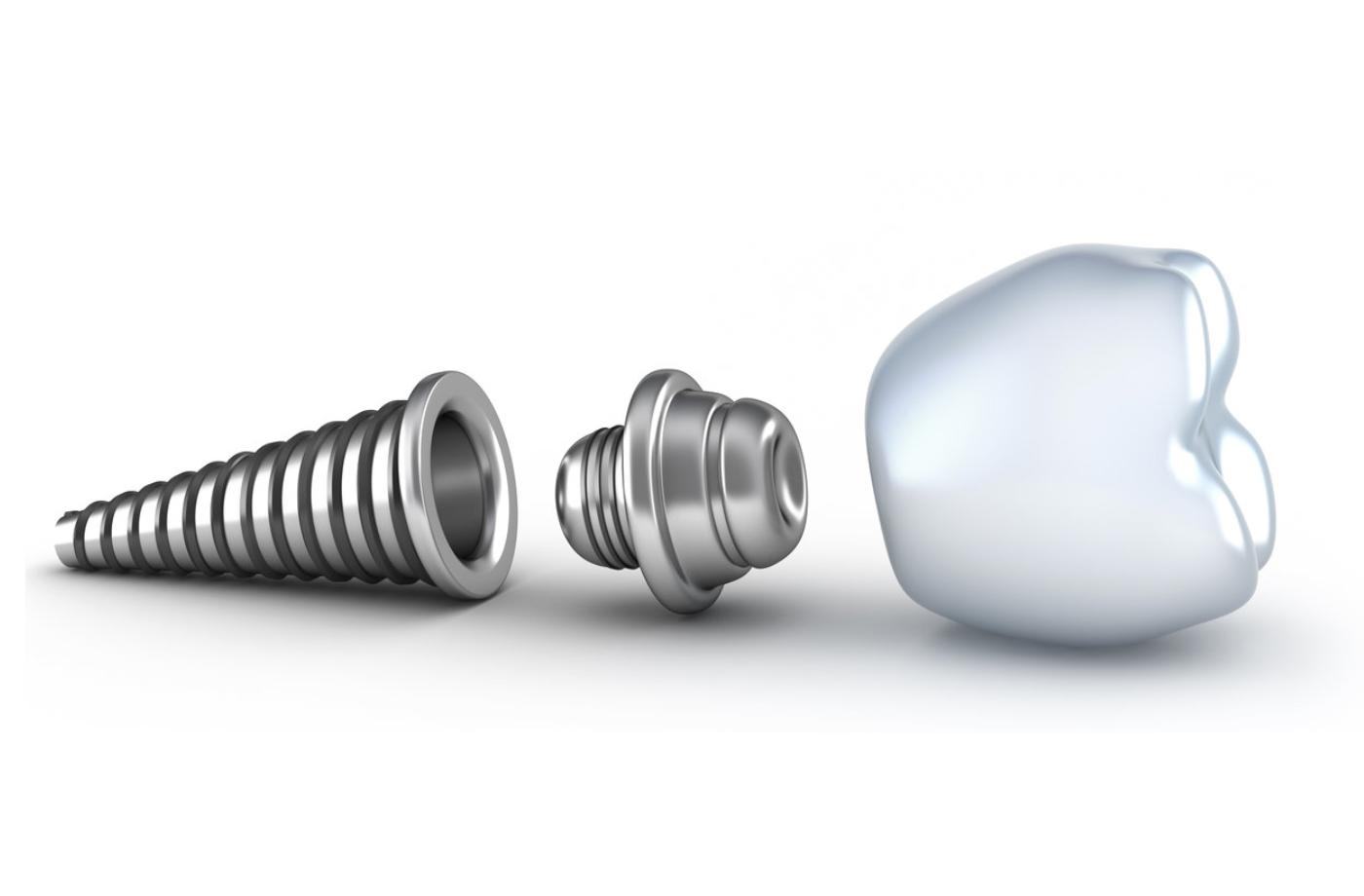 cấu tạo và các loại implant hàn quốc