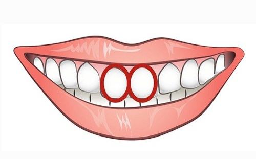 Tướng số của người có răng thỏ 